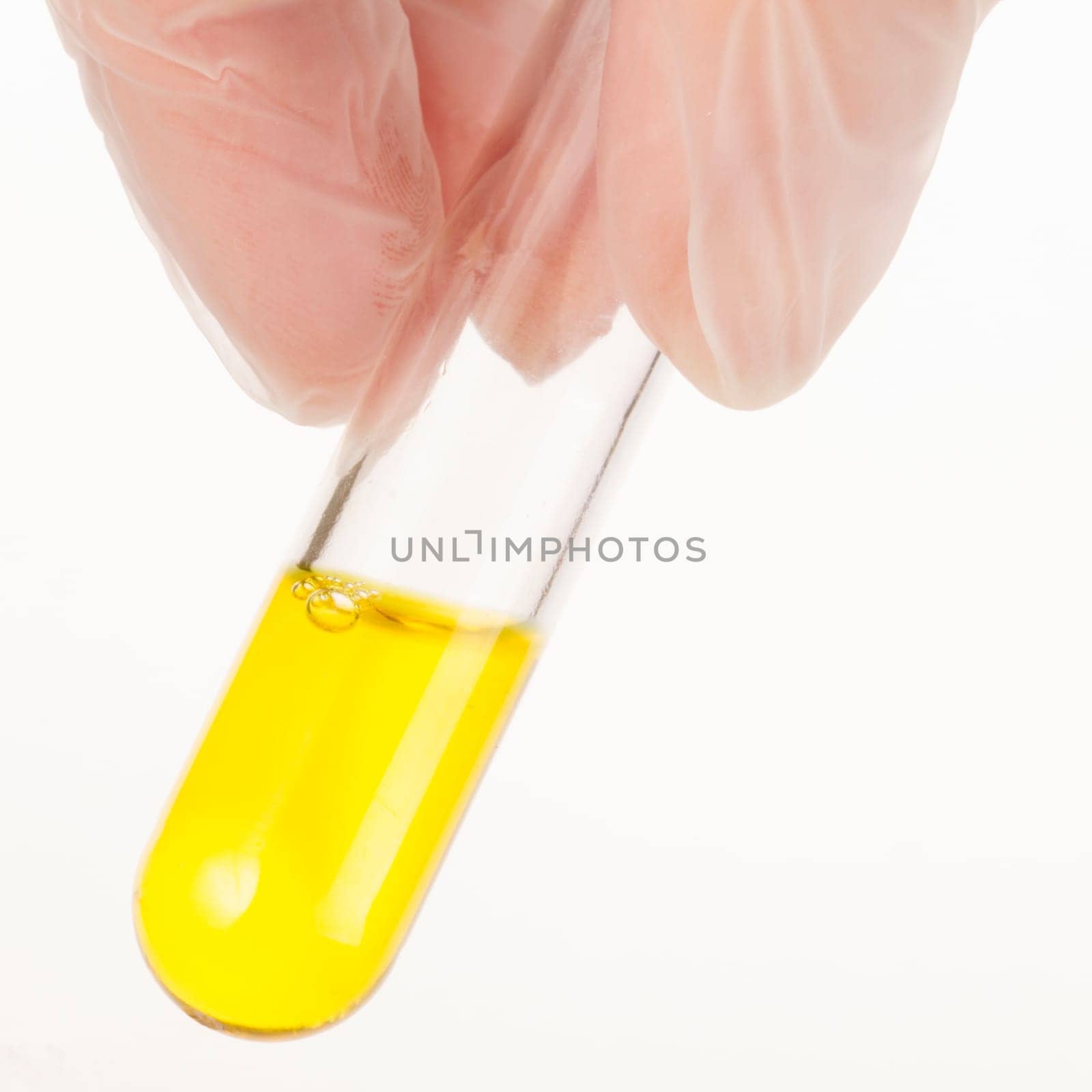 Fingers holding test tube with yellow liquid.