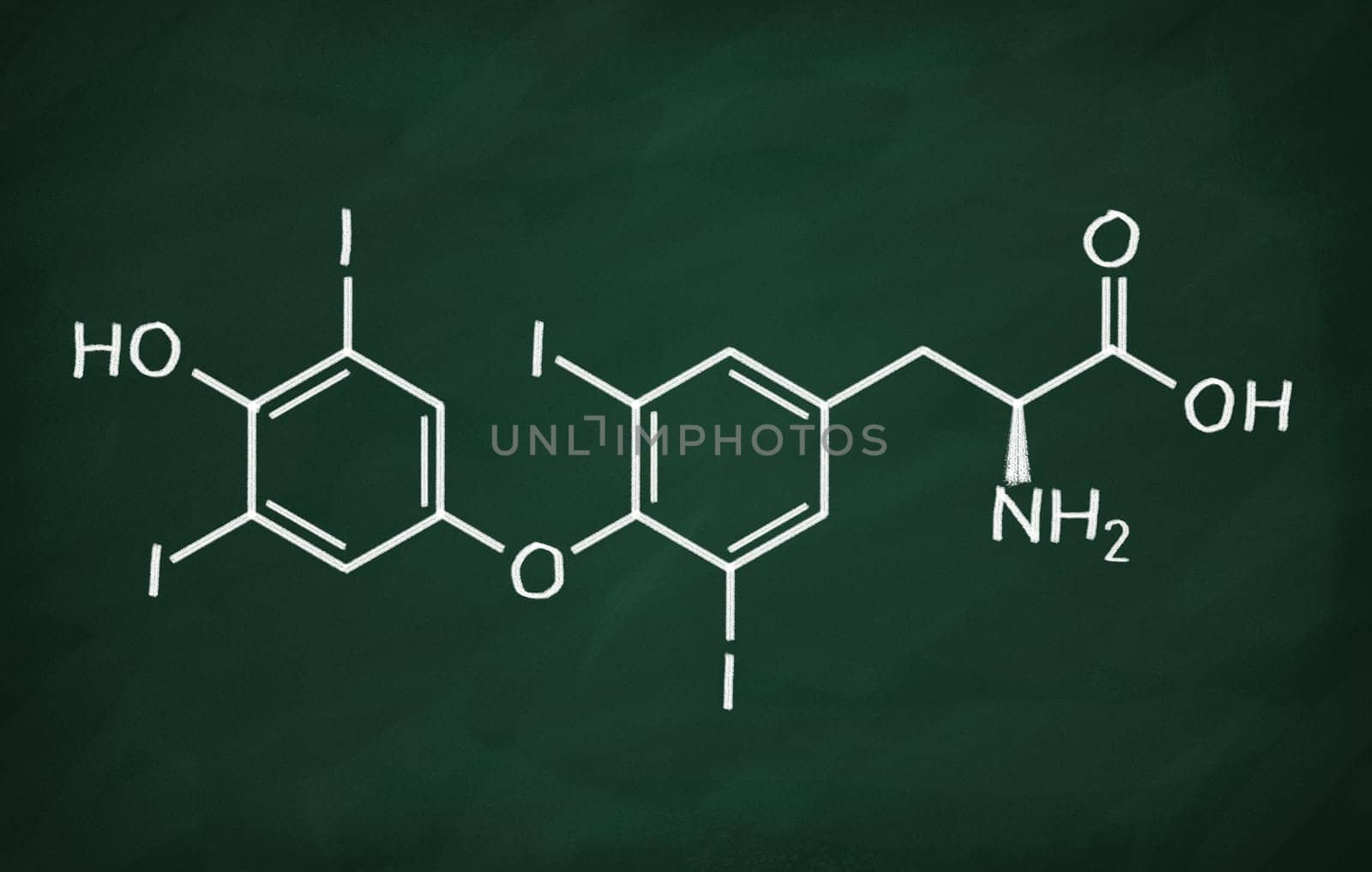Structural model of Thyroxin on the blackboard.