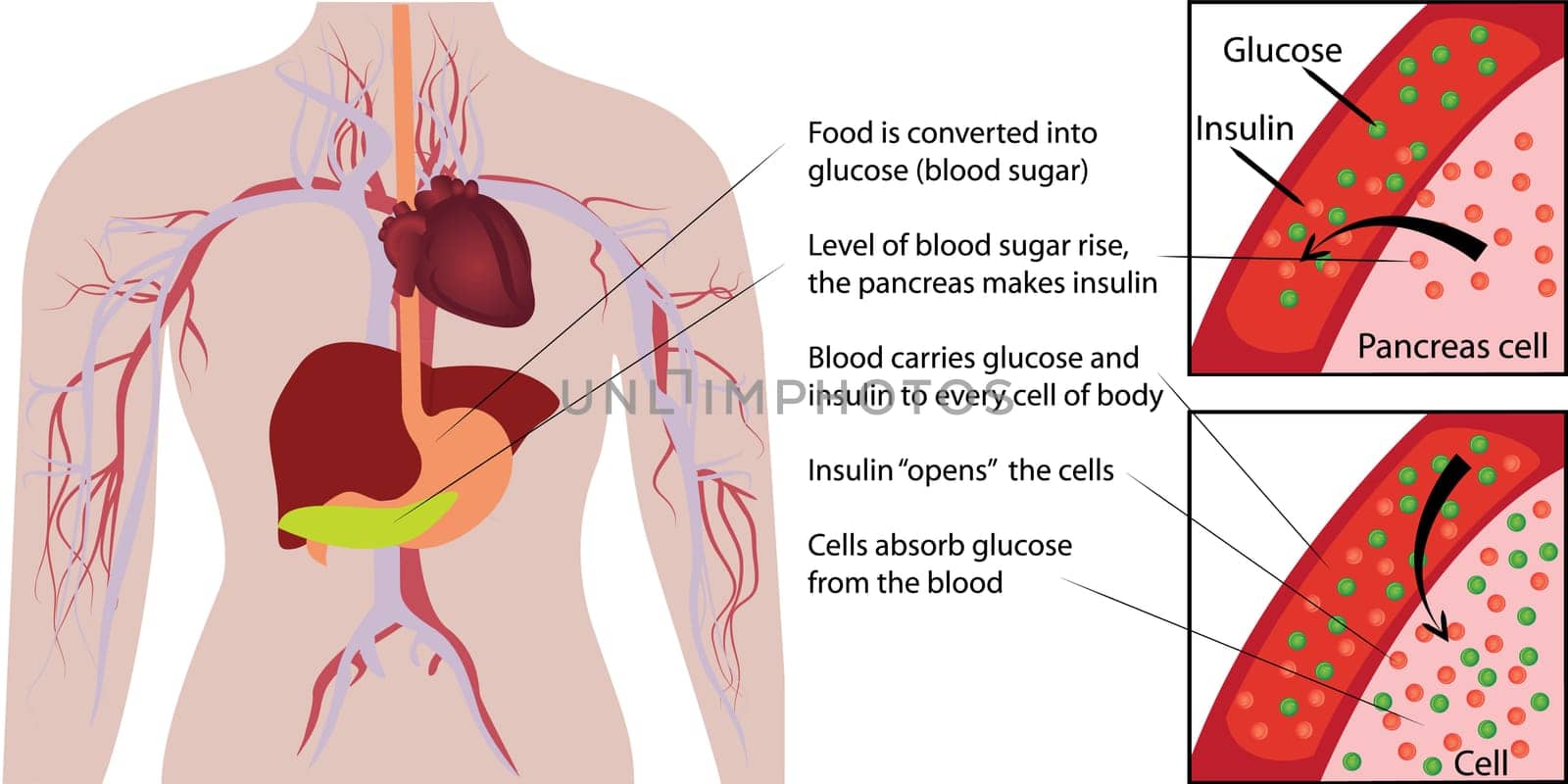Blood sugar glucose absorption in a human body infographics vector illustration