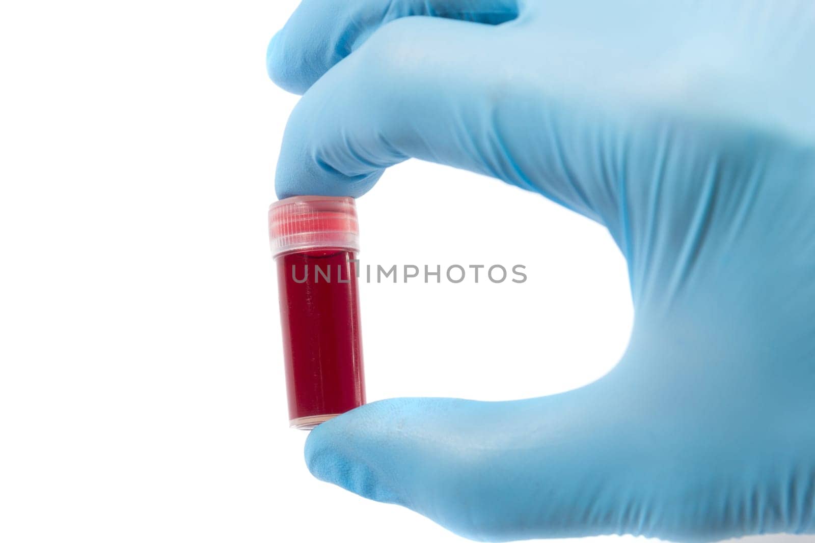 Blood test tube in doctor hand with blue medical gloves.