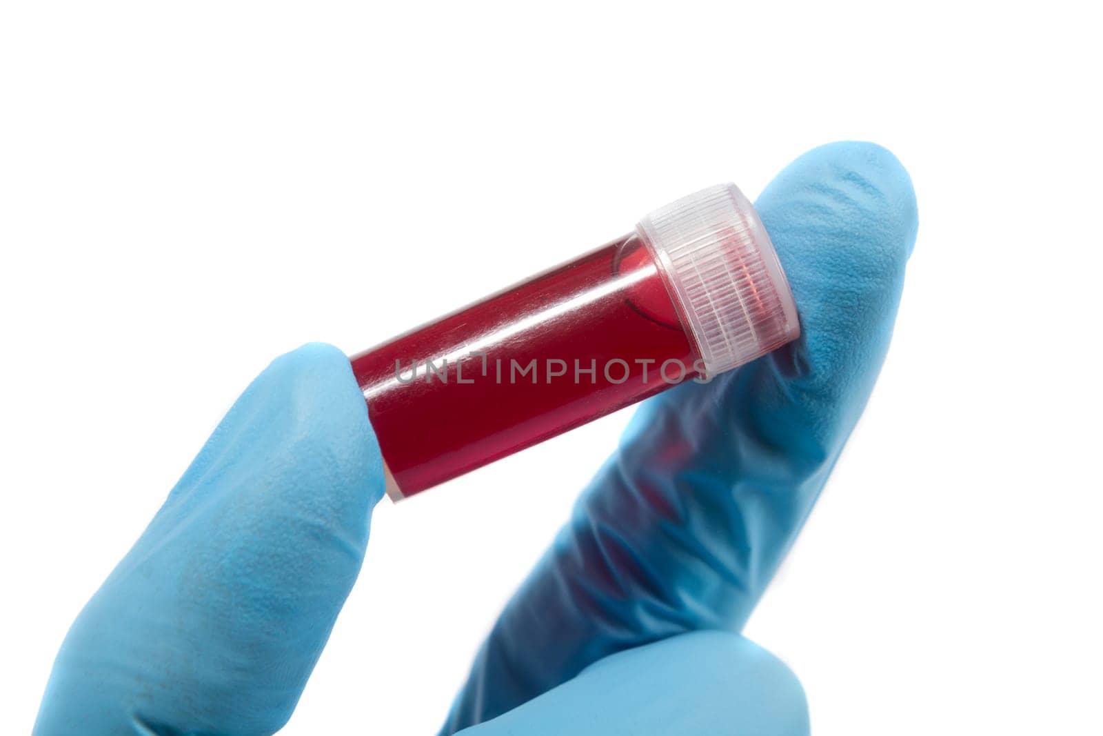 Blood test tube in doctor hand with blue medical gloves.