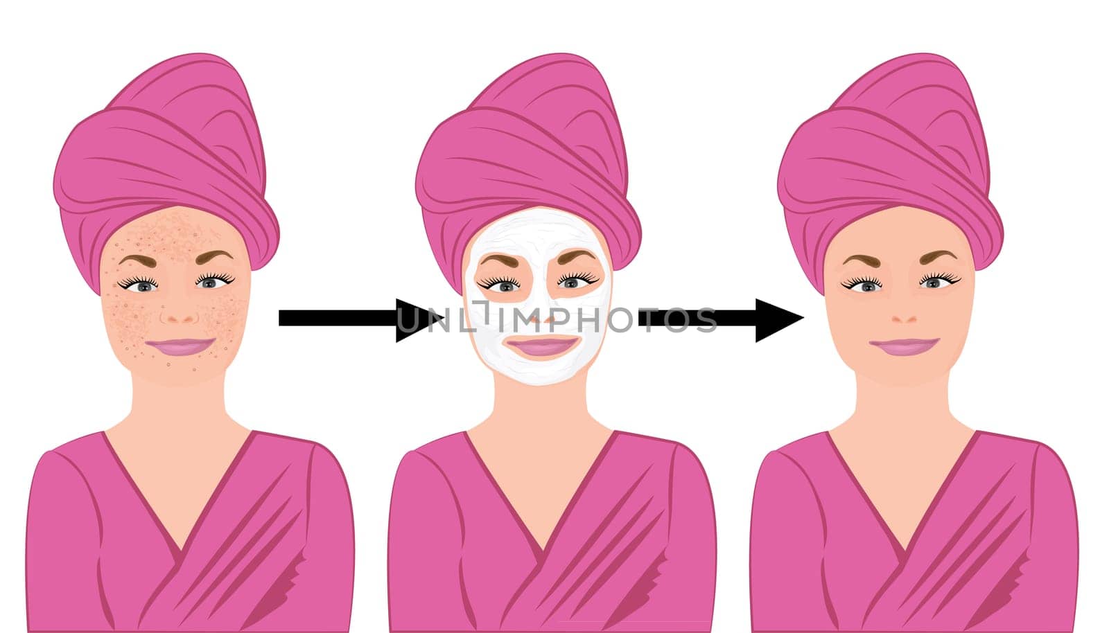 Acne skin disease before and after treatment vector illustration