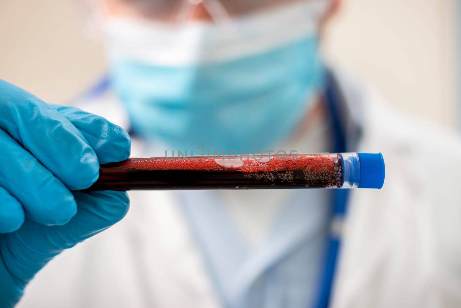 View of a doctor holding a fictional test tube blood sample, possibly infected.