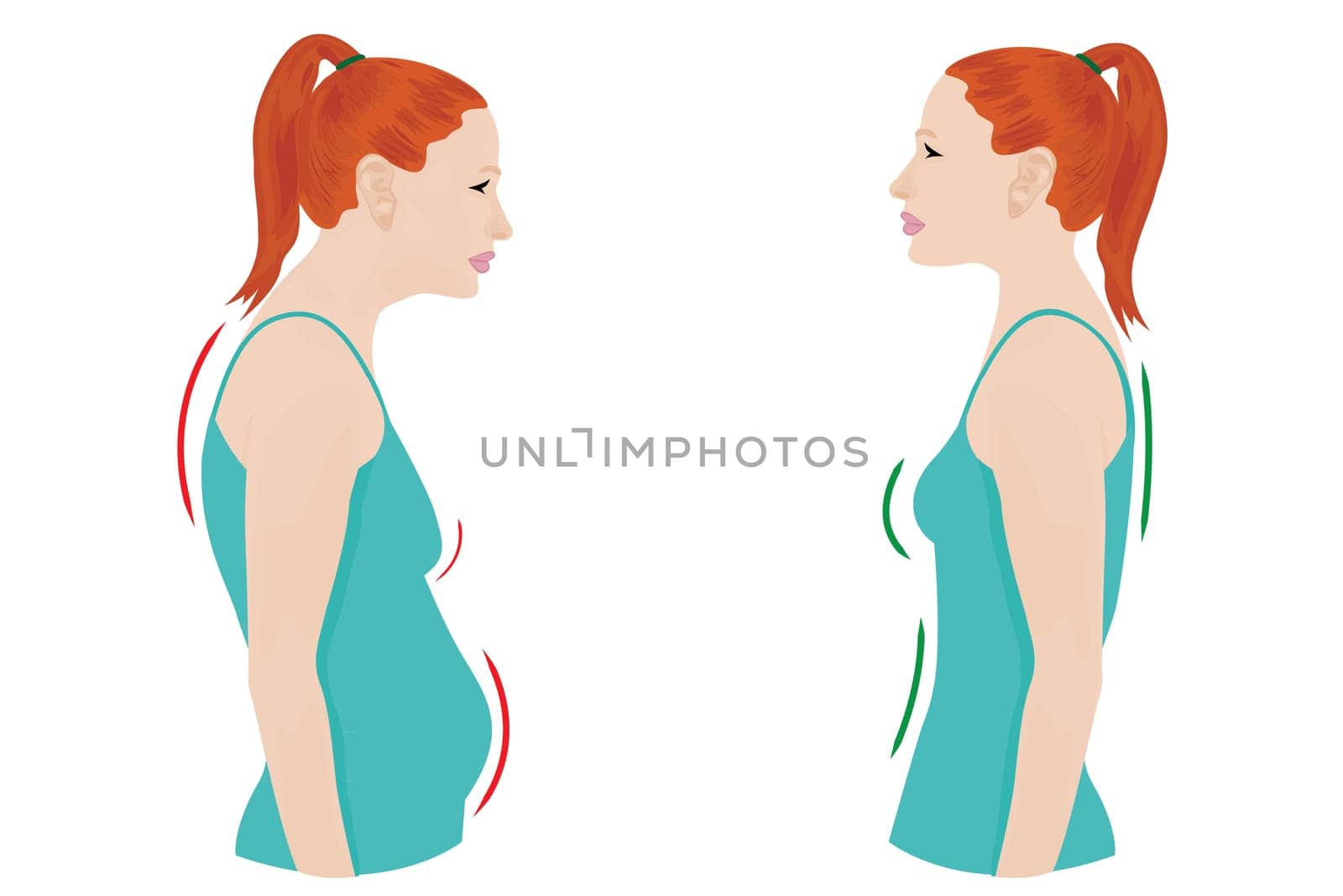 Good and bad posture woman figure vector illustration before and after figure correction
