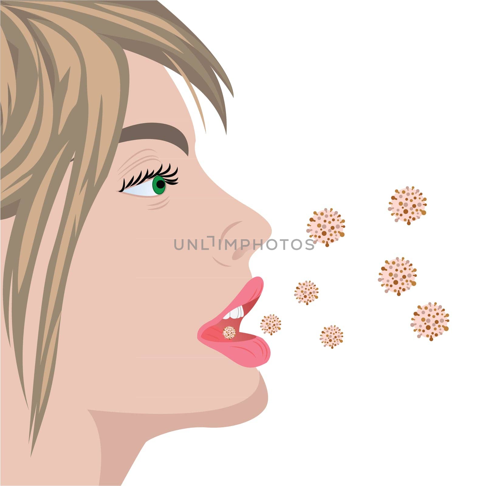 Viruses infection flu bacterial overgrowth producing bad smell breathe in a mouth vector illustration on a white background