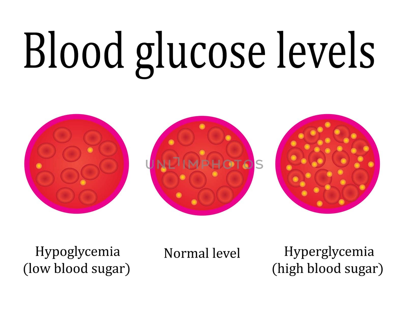 regulations blood sugar level control medical lab analysis vector illustration infographics