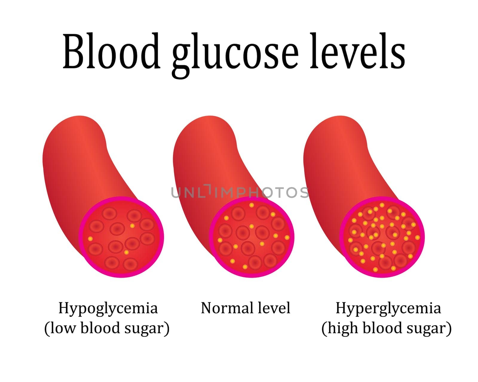 regulations blood sugar level control medical lab analysis vector illustration infographics