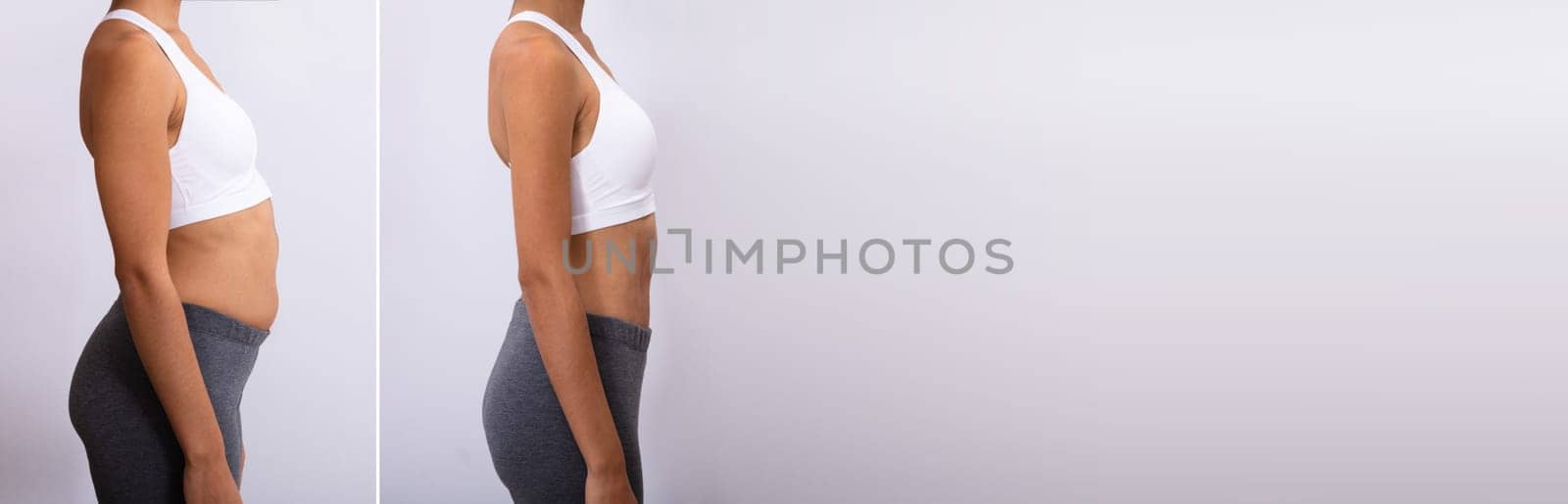 Before And After Concept Showing Fat To Slim Woman