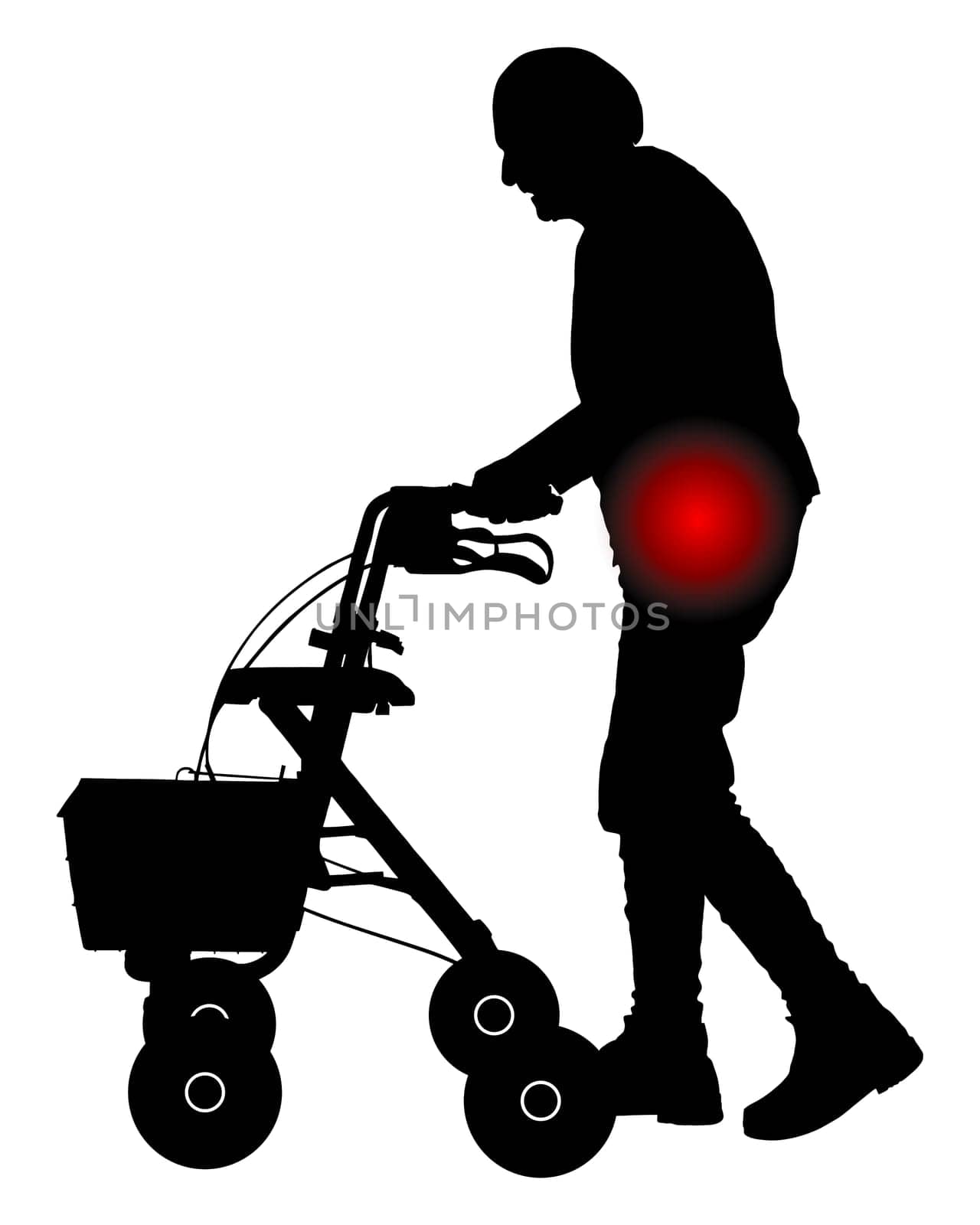 Seniorin mit Hüftschmerzen und Rollator