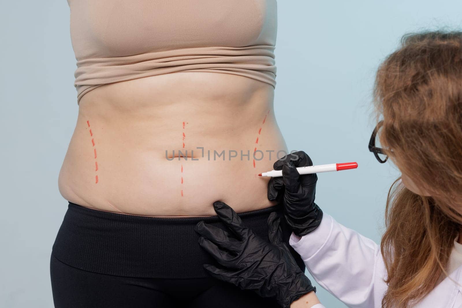 Close up of doctor drawing marks on woman body before plastic surgery. Patient in black underwear standing in front of surgeon while man drawing line on her bare skin. Concept of plastics surgery.