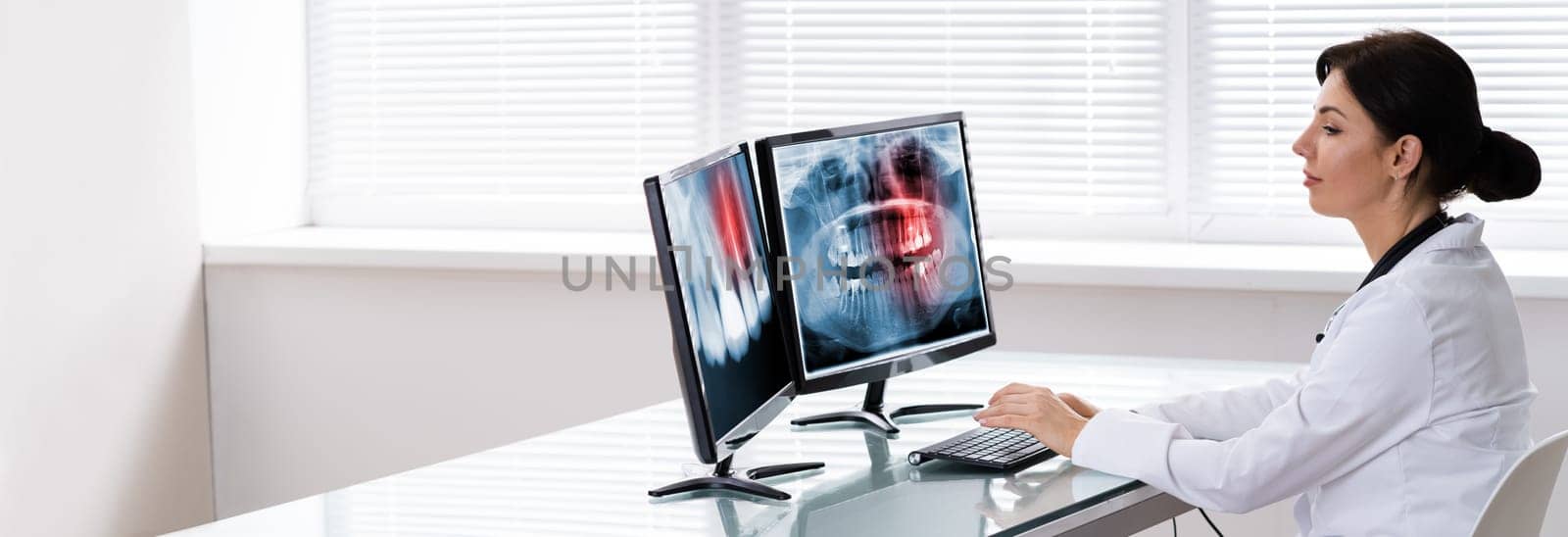 Dentist Doctor Looking At Teeth Xray On Computer
