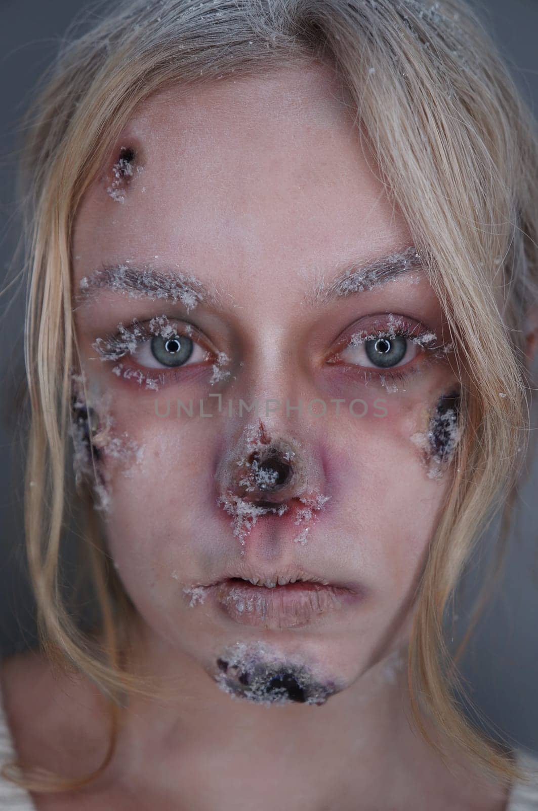 young blond woman with frostbite sfx makeup