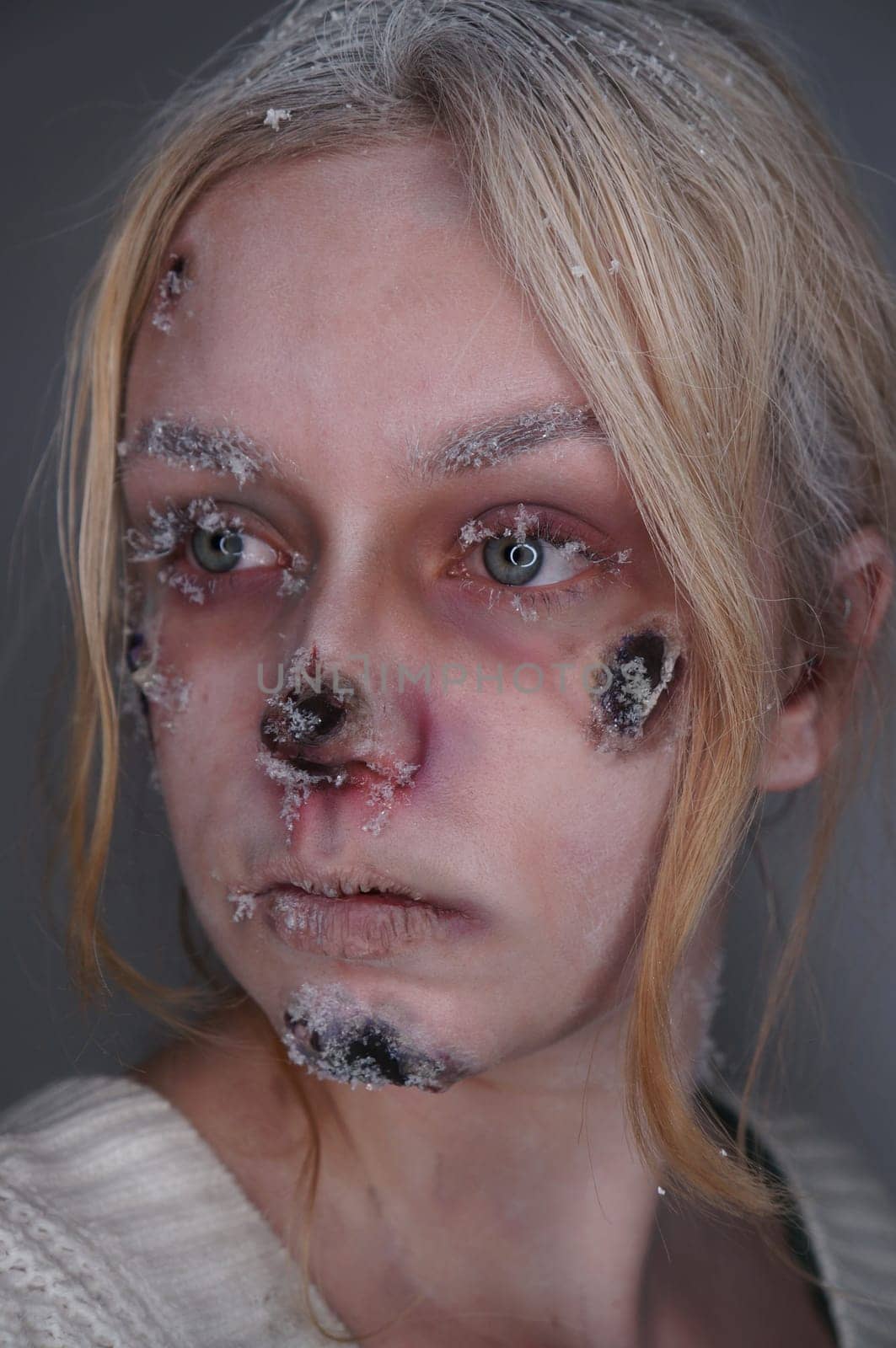 young blond woman with frostbite sfx makeup
