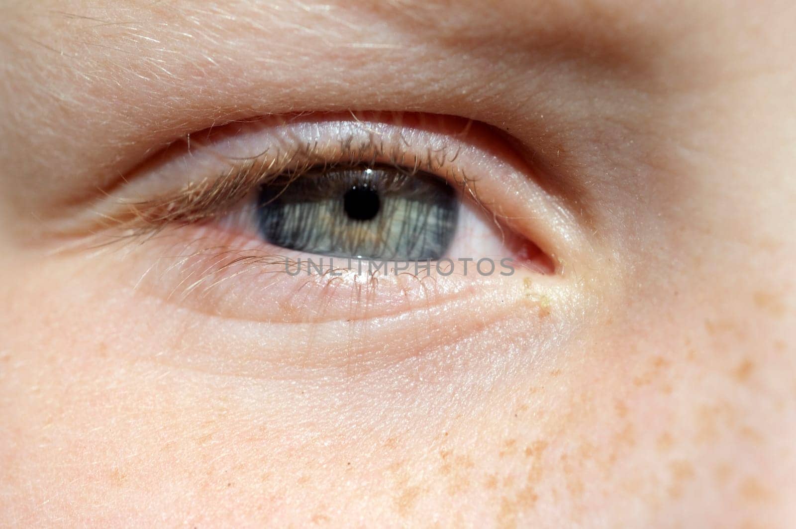 Auge, Lid, iris, Maedchenauge