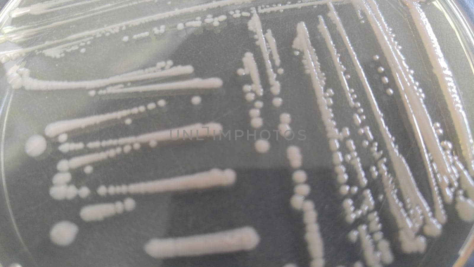 petri dish with various bacteria colonies on agar