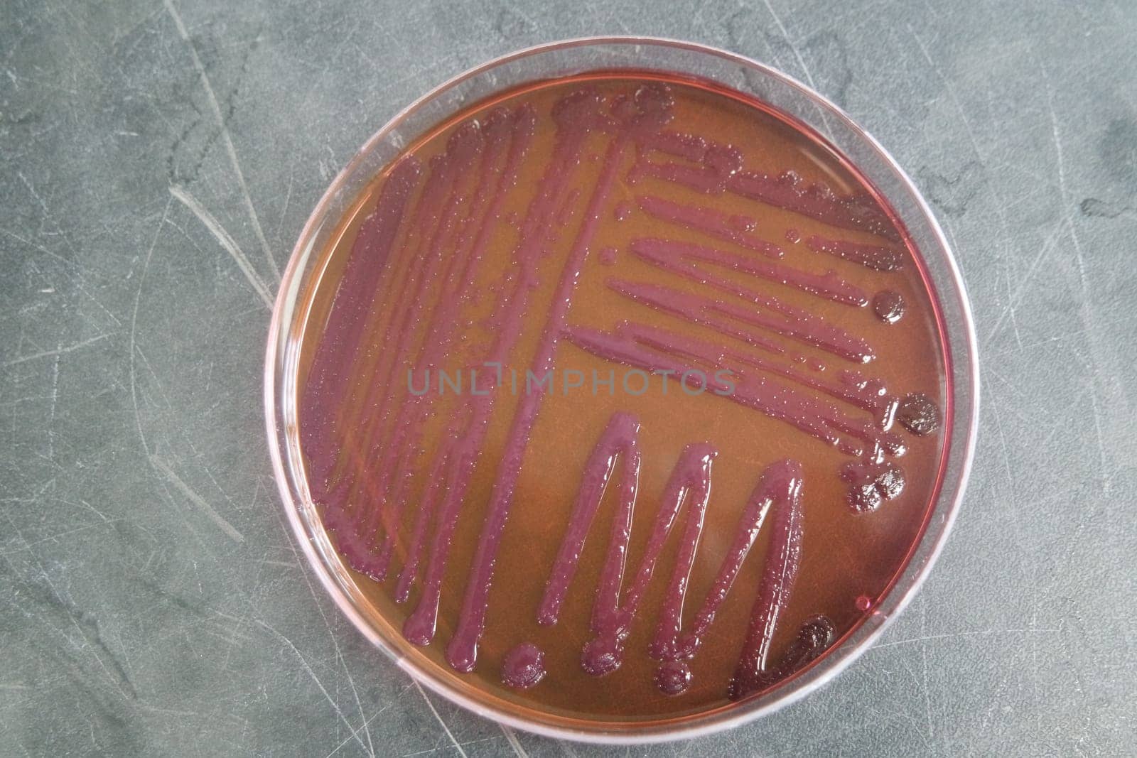 petri dish with various bacteria colonies on agar