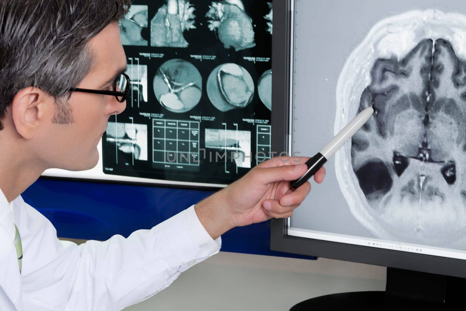 Doctor examining MRI report