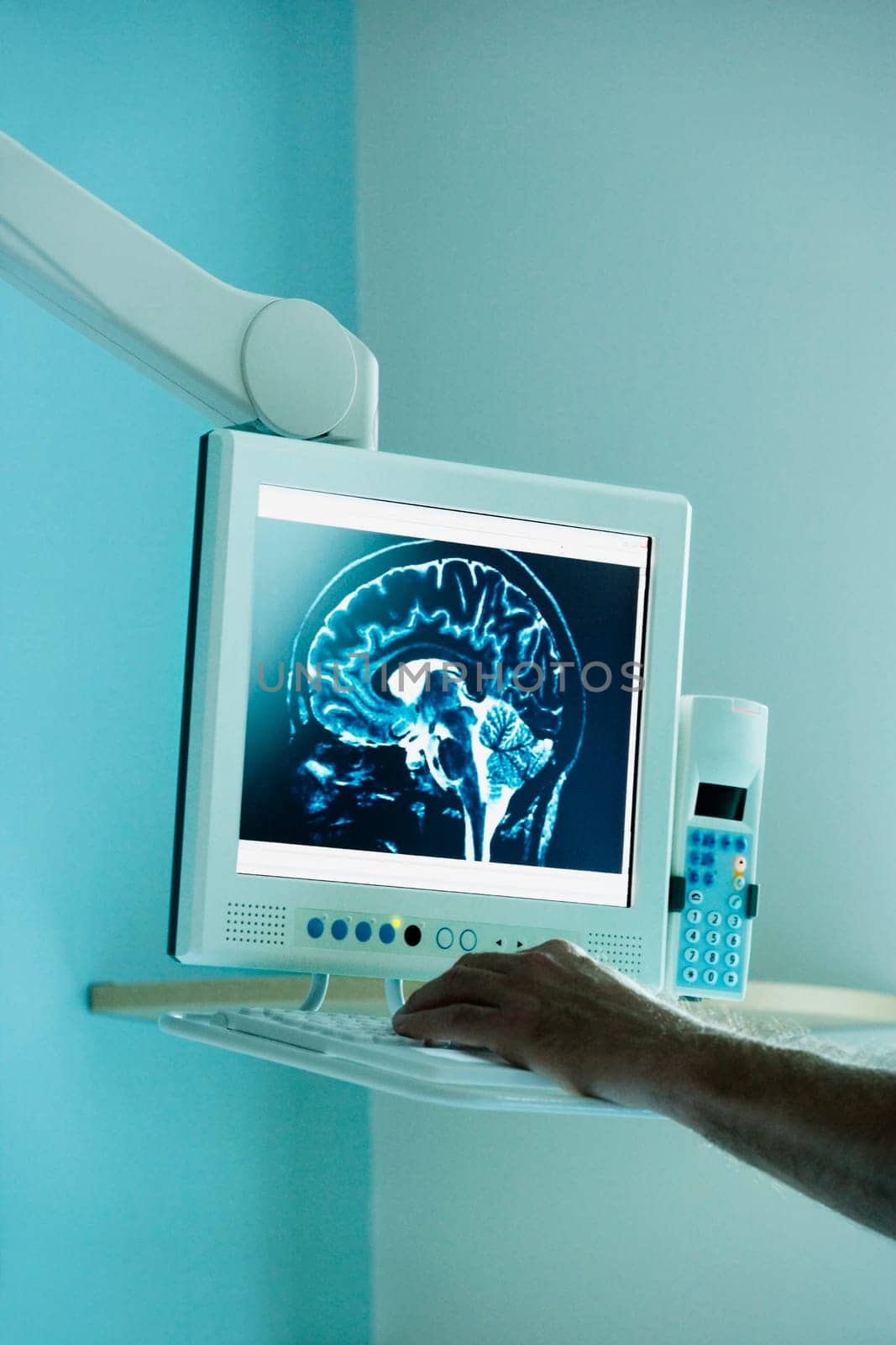 Doctor examining MRI scan on a computer screen