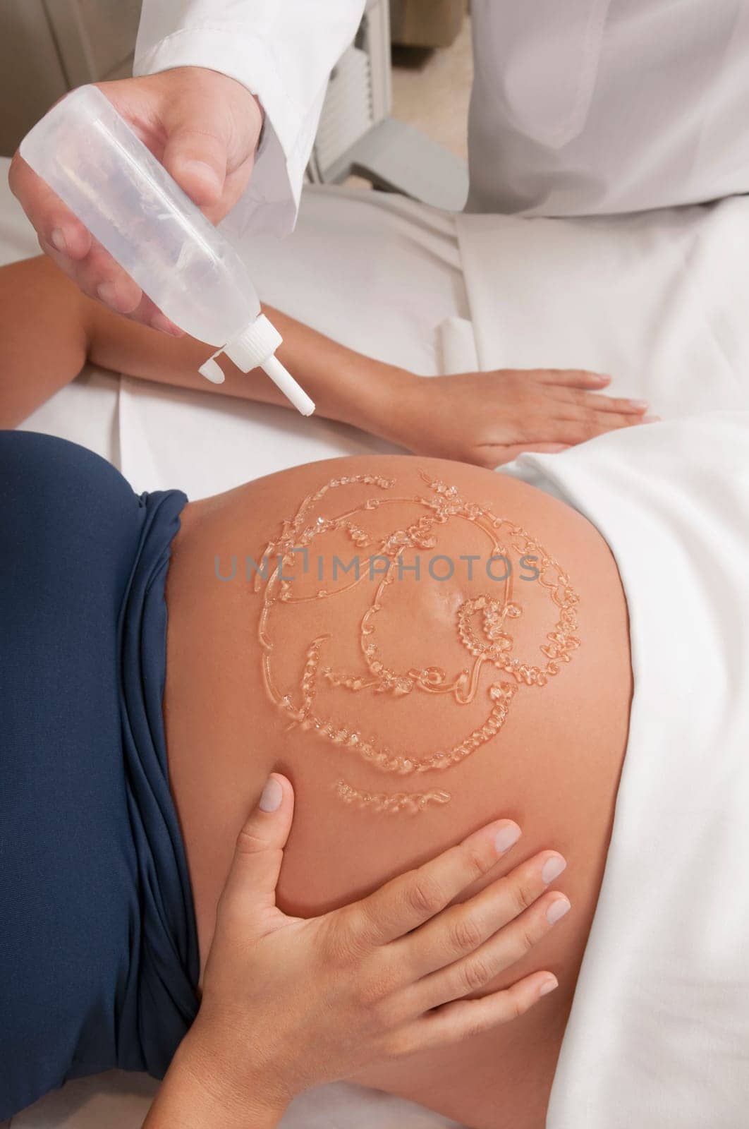 Pregnant woman going through an ultrasound scan