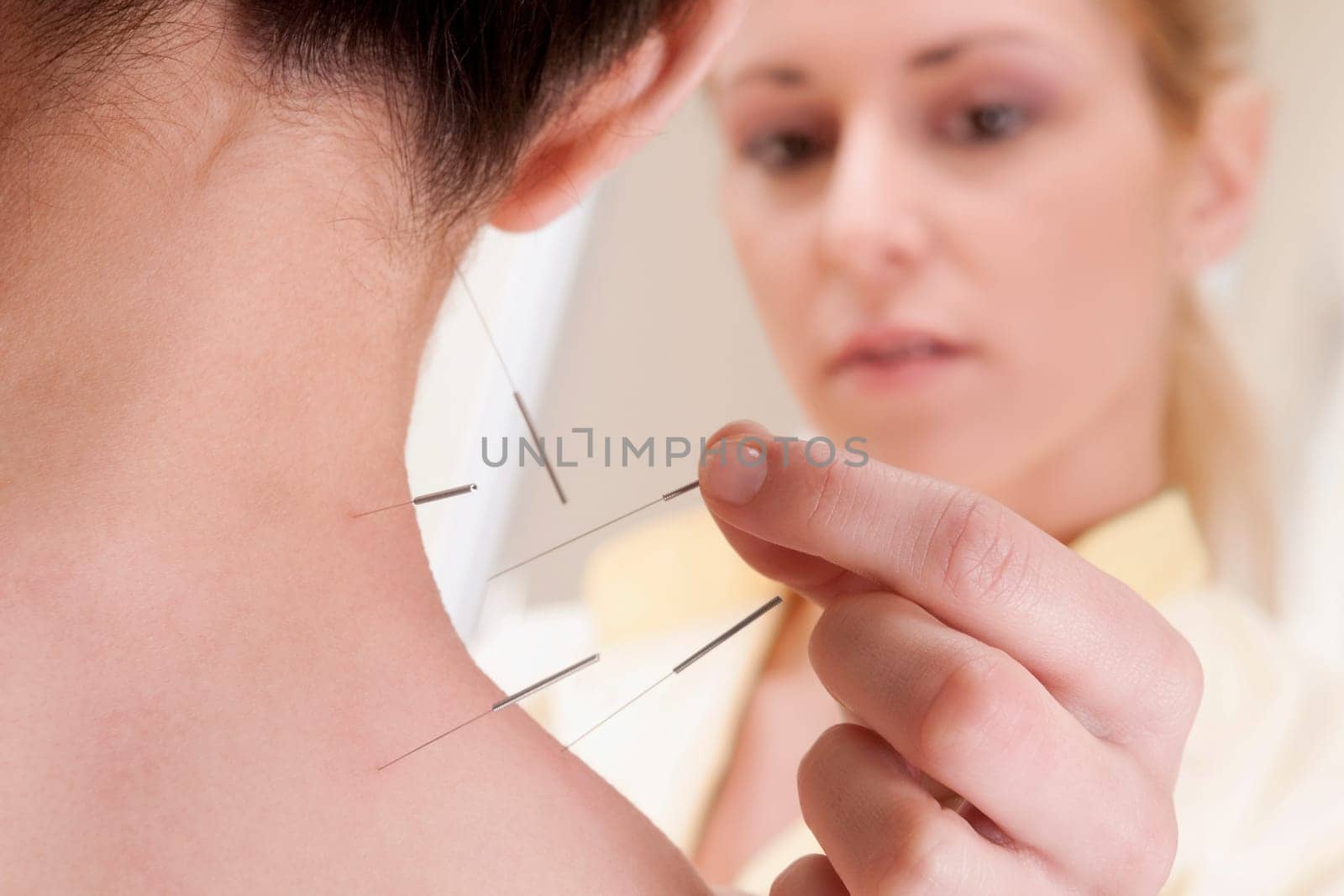 Acupuncturist applying needles on a personŽs back