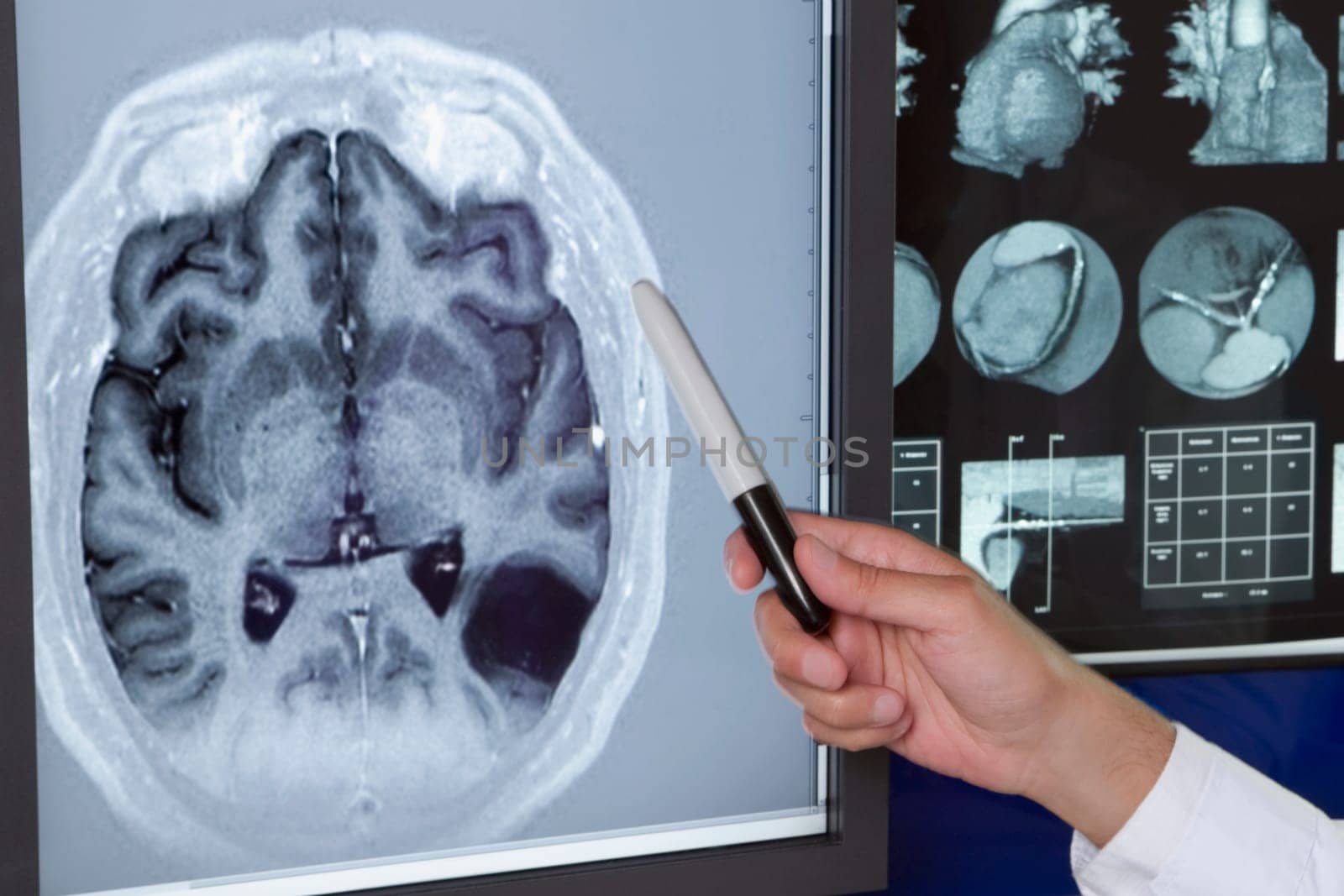 Doctor examining MRI report