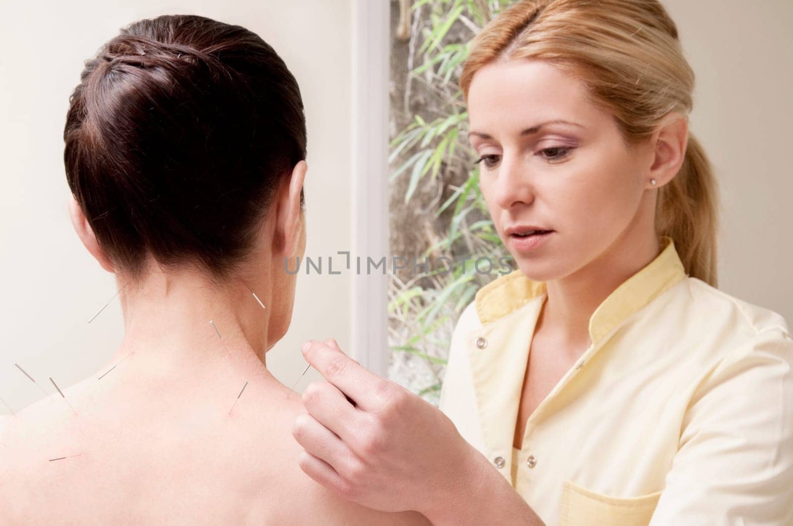 Acupuncturist applying needles on a womanŽs back