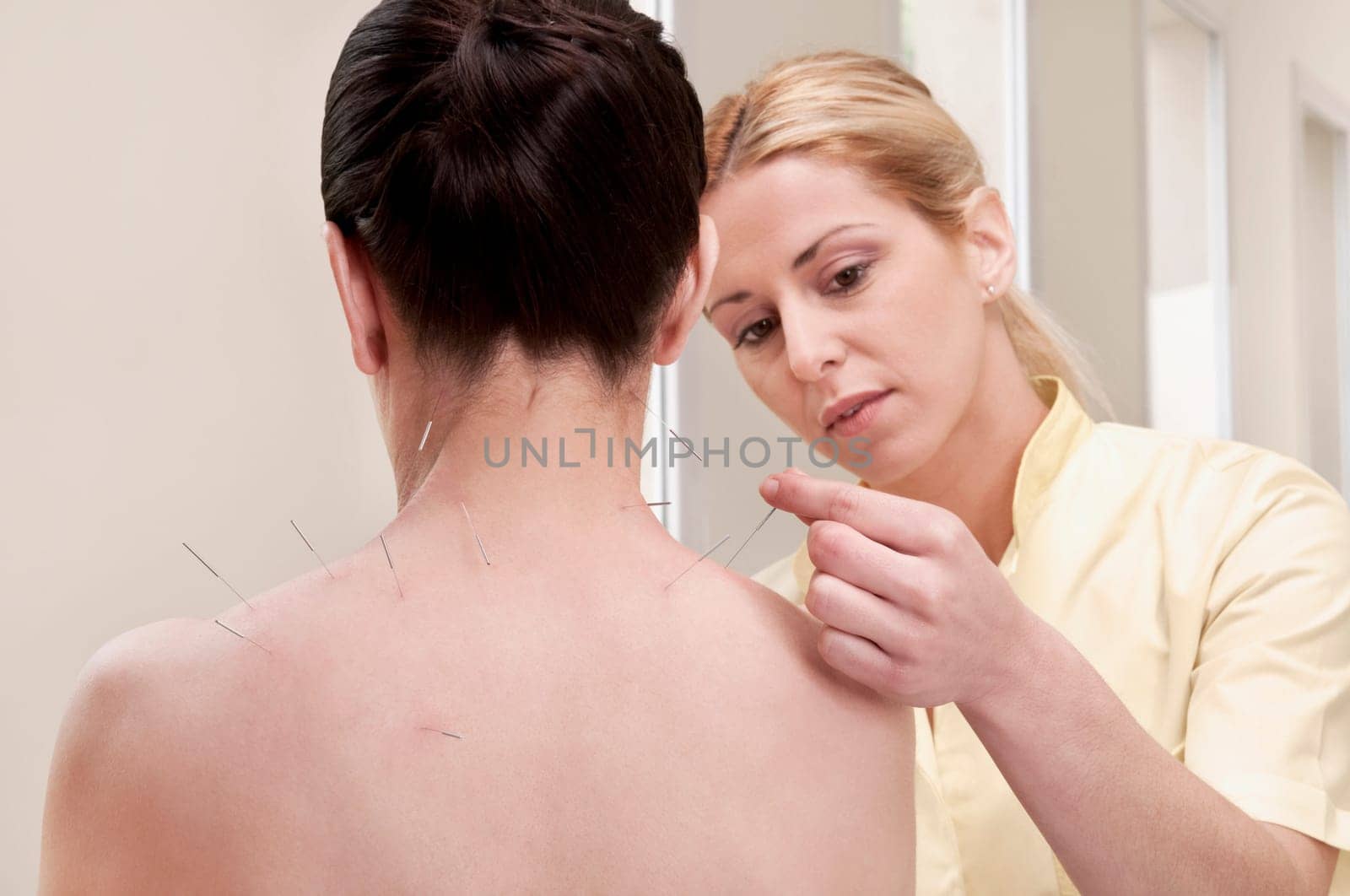 Acupuncturist applying needles on a womanŽs back