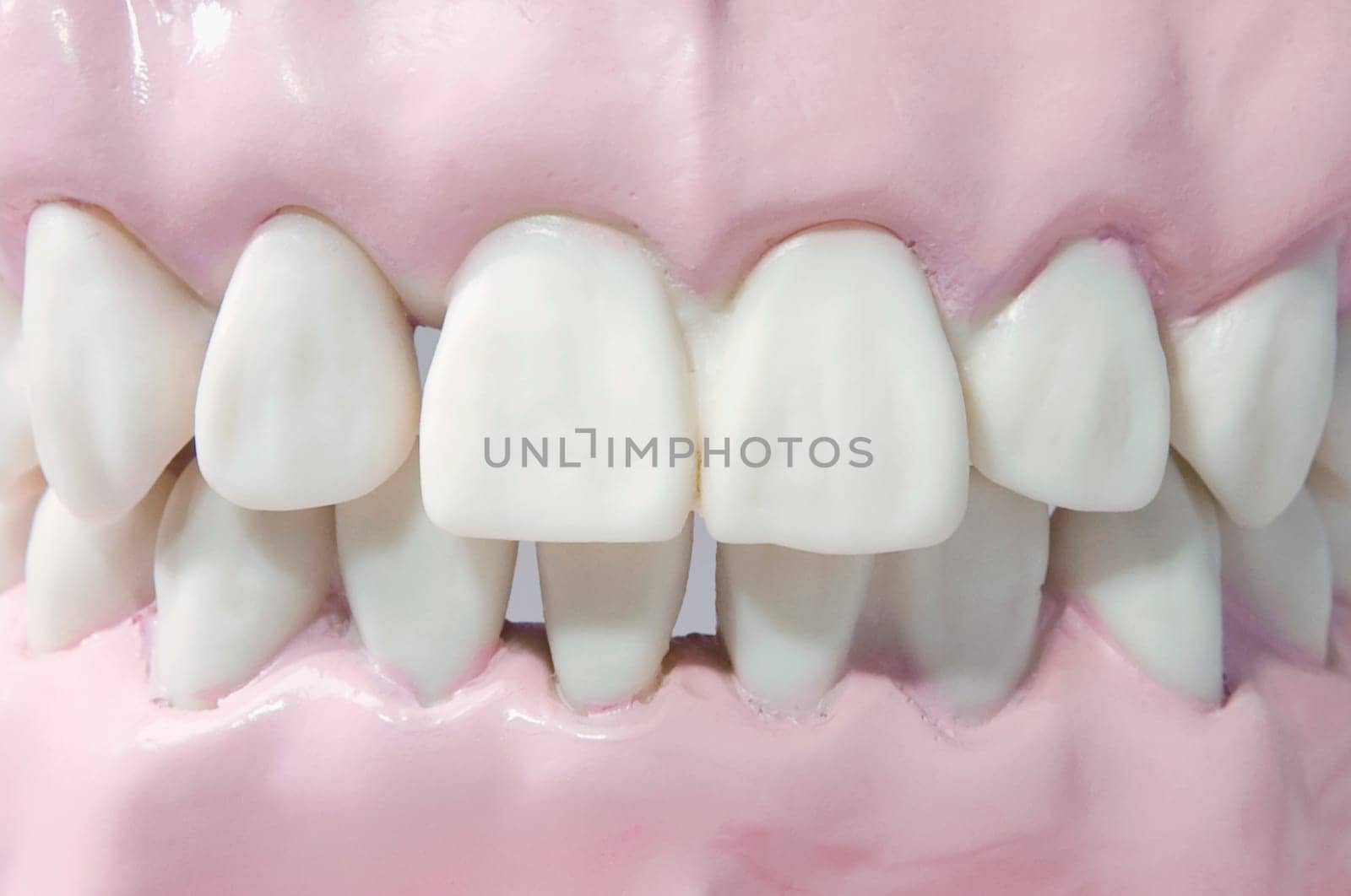 Close_up of a set of dentures