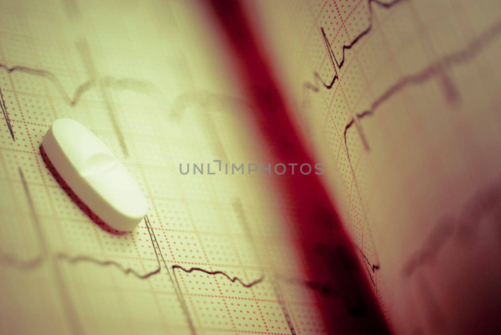 Close_up of a pill on an ecg report
