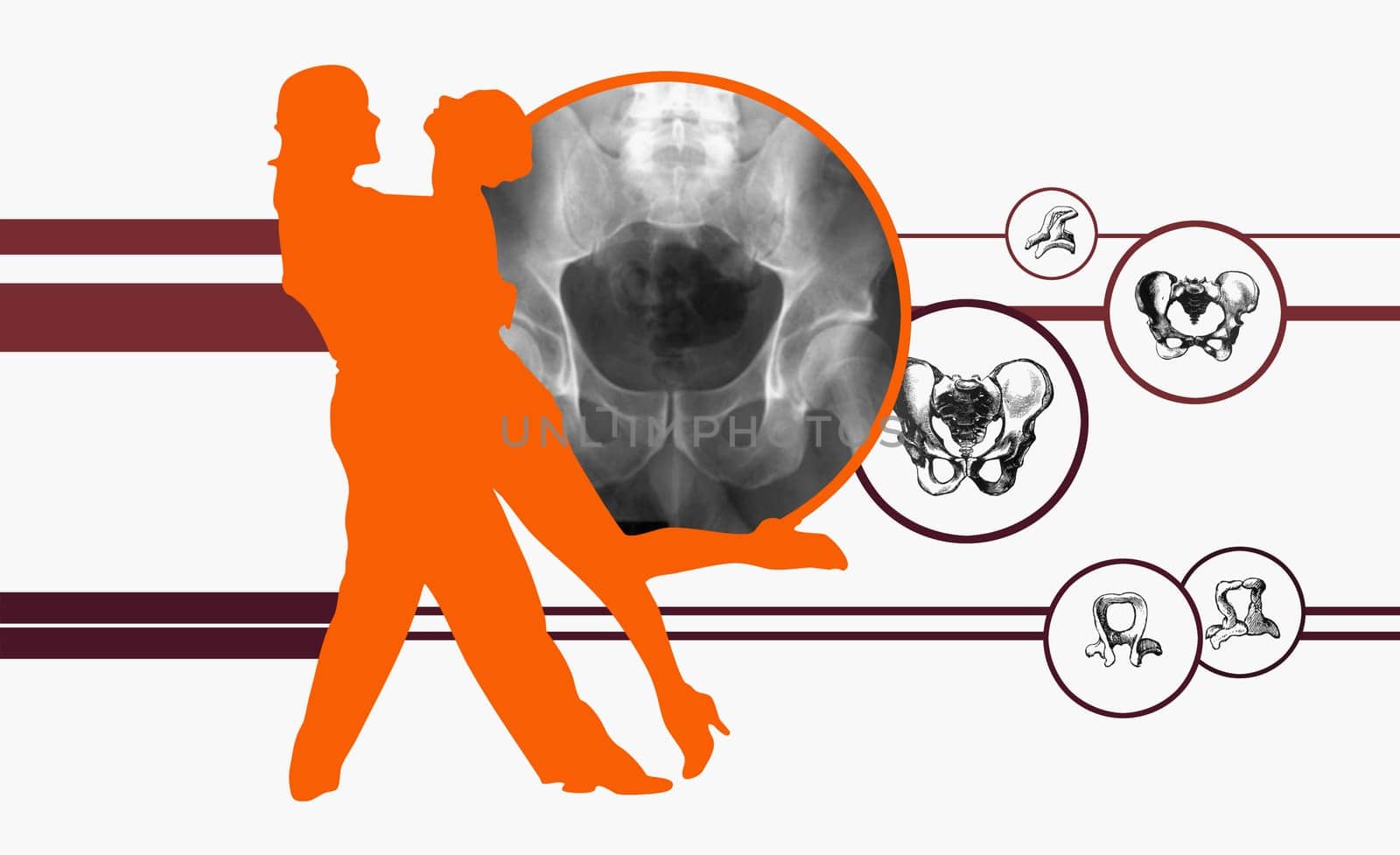 Couple dancing on diagrams of human bones