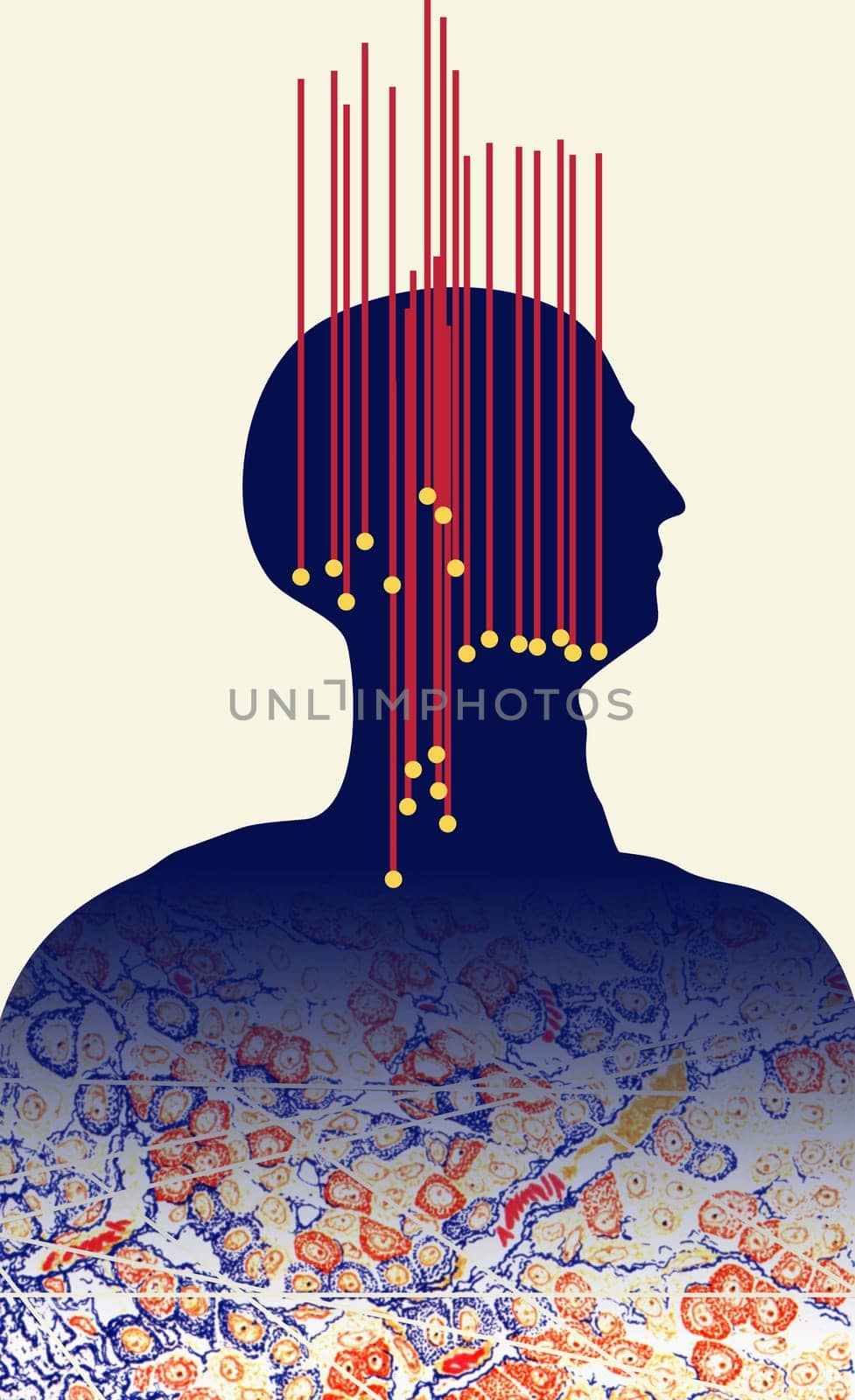 Acupuncture pressure points
