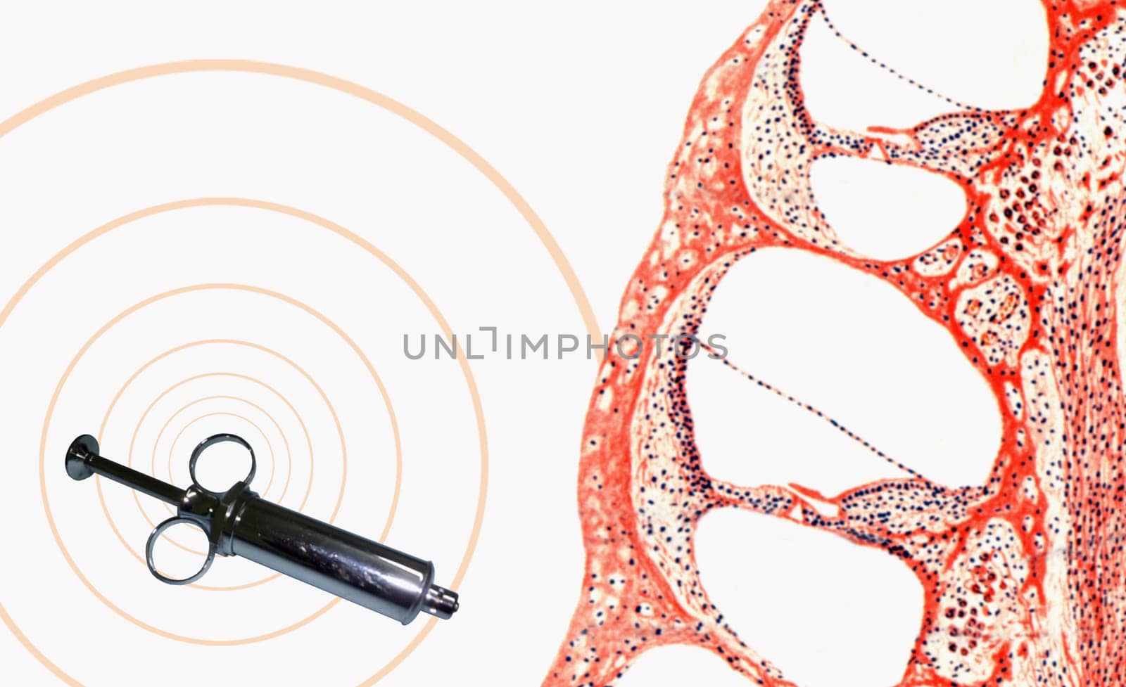 Close-up of a syringe