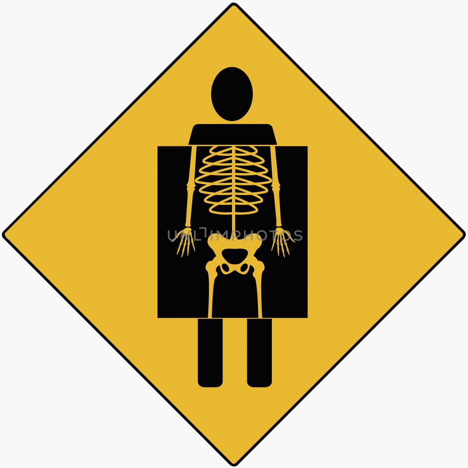 X-Ray showing human skeleton