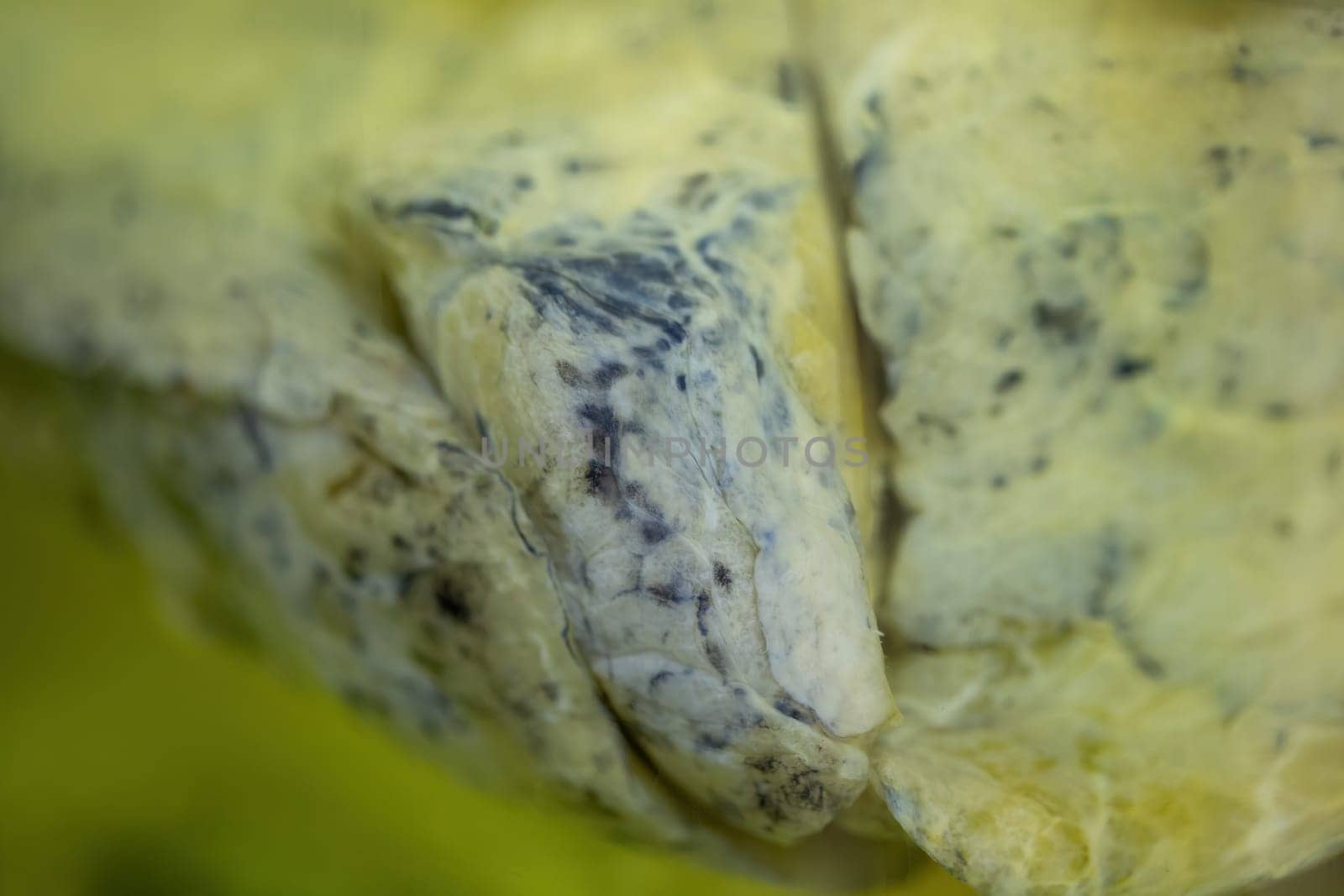 Close-up of lung of a dead smoker with black spots. Forensic photo of human organ in pathological condition after inhaling smoke and polluted air. Smoking kills.