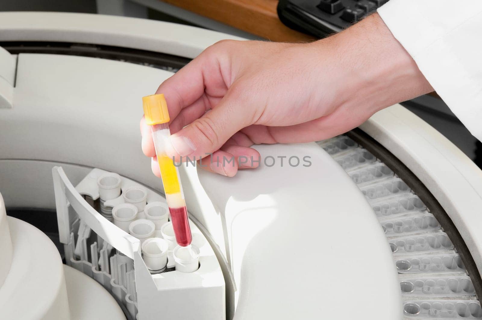 Lab technician putting a blood sample in the laboratory freezer