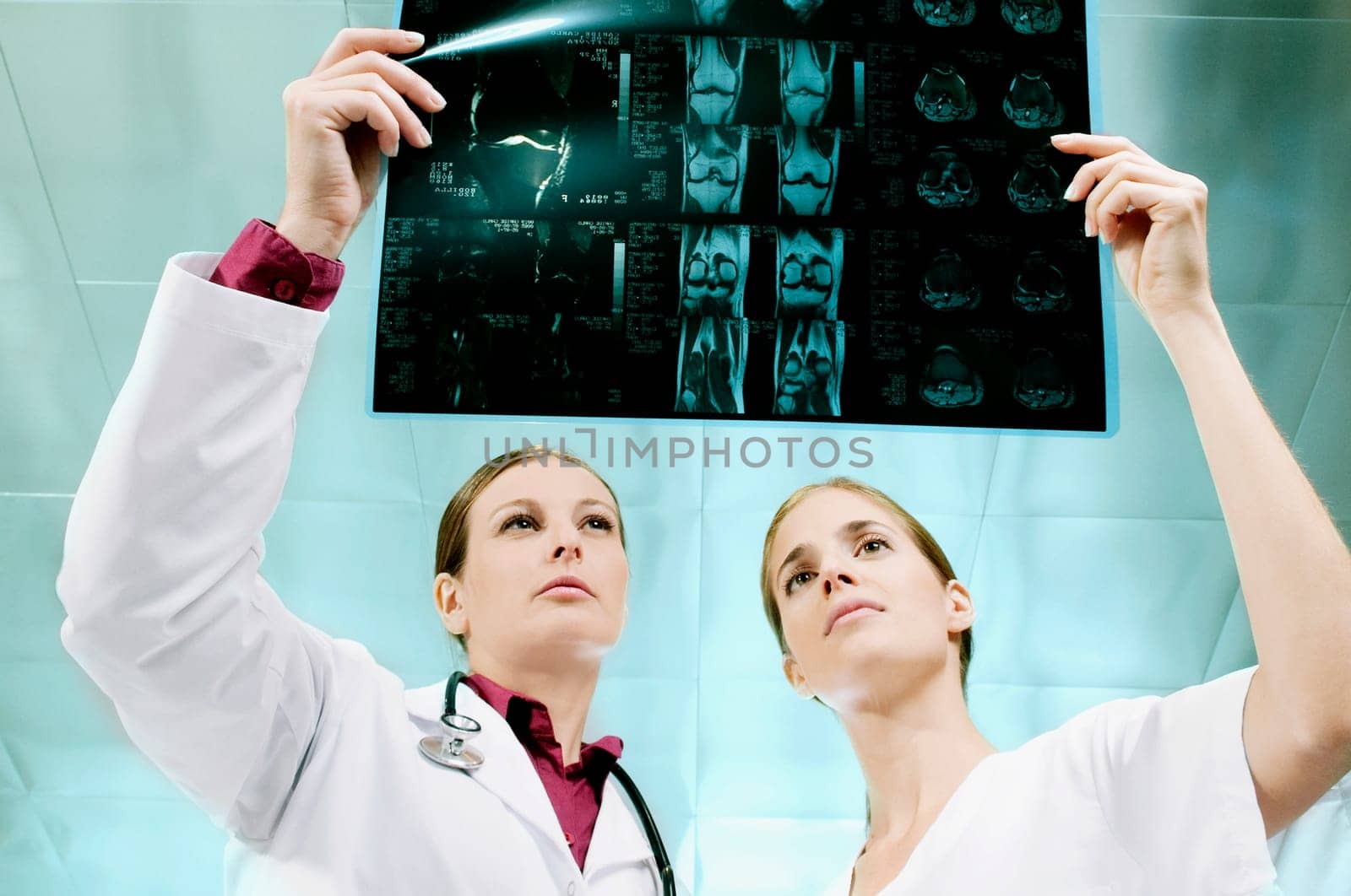 Female doctor and a nurse examining an X_Ray