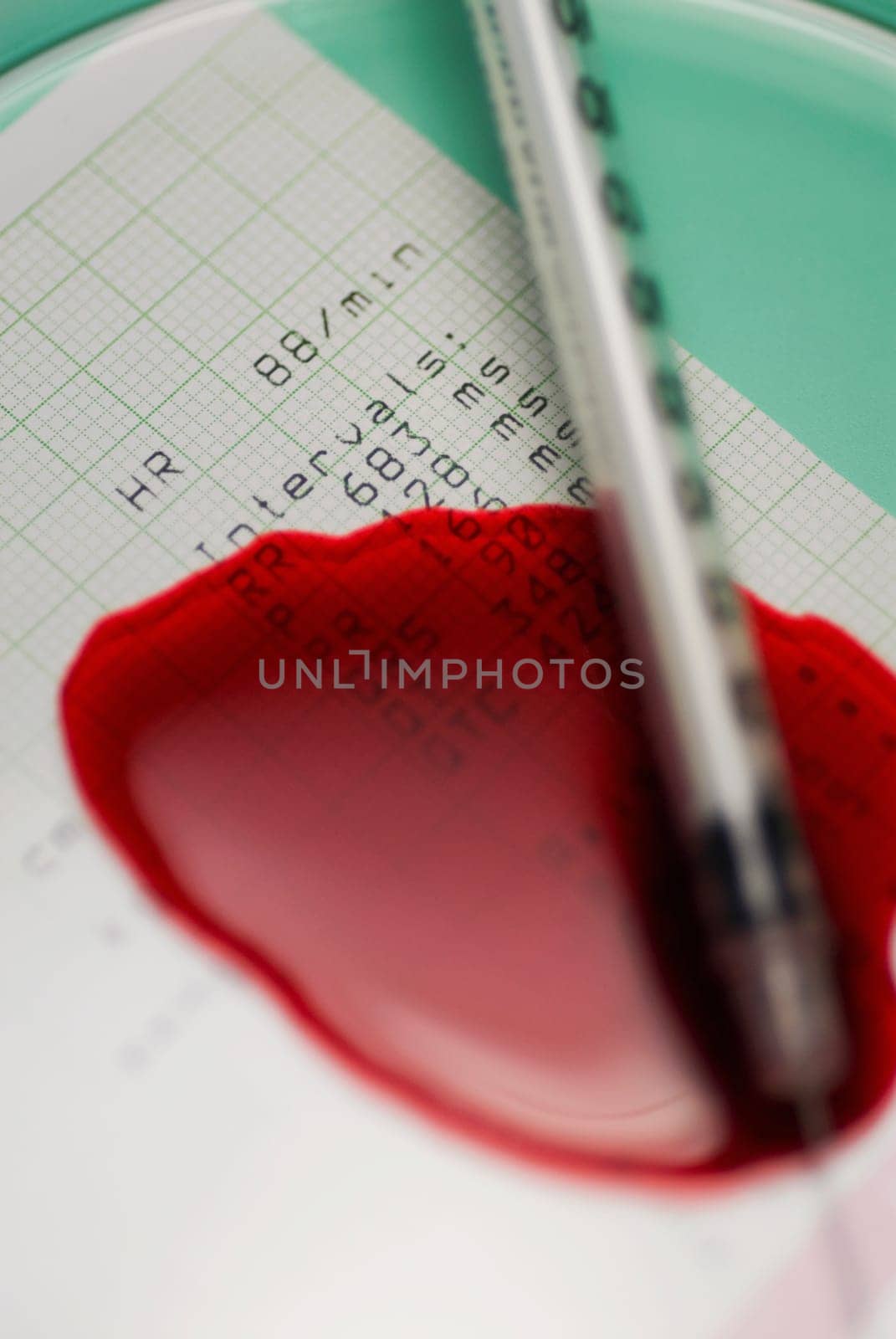 Close_up of a syringe with blood on an electrocardiogram report