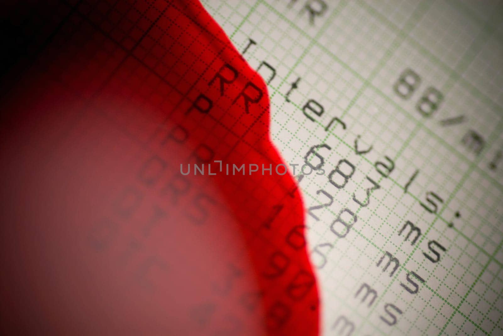 Close_up of blood split on an electrocardiogram report