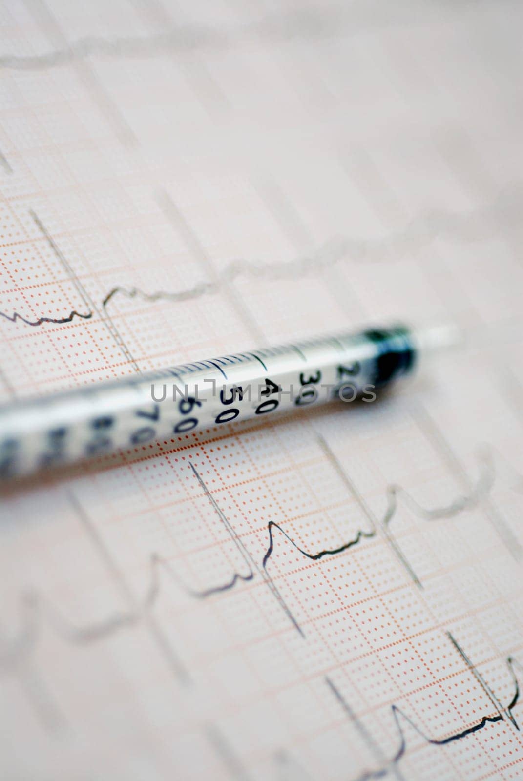 Close-up of an injection on an ECG report