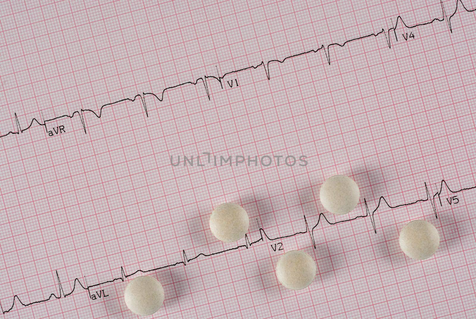 Close_up of pills on a medical report