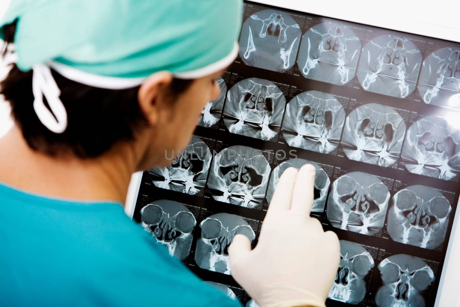 Rear view of a surgeon looking at an X-Ray