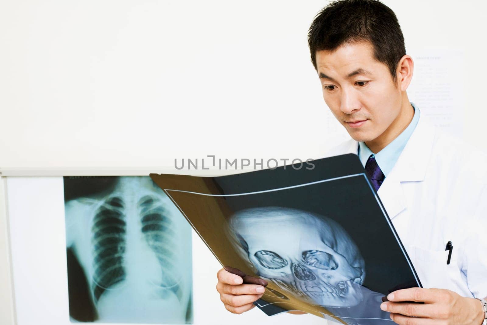 Close-up of a male doctor examining an X-Ray