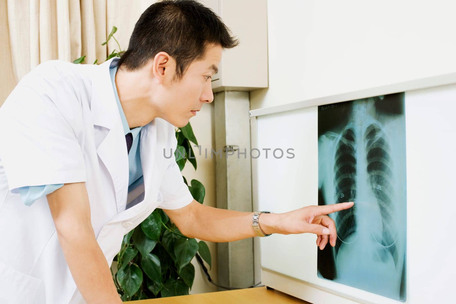 Close-up of a male doctor pointing to an X-Ray