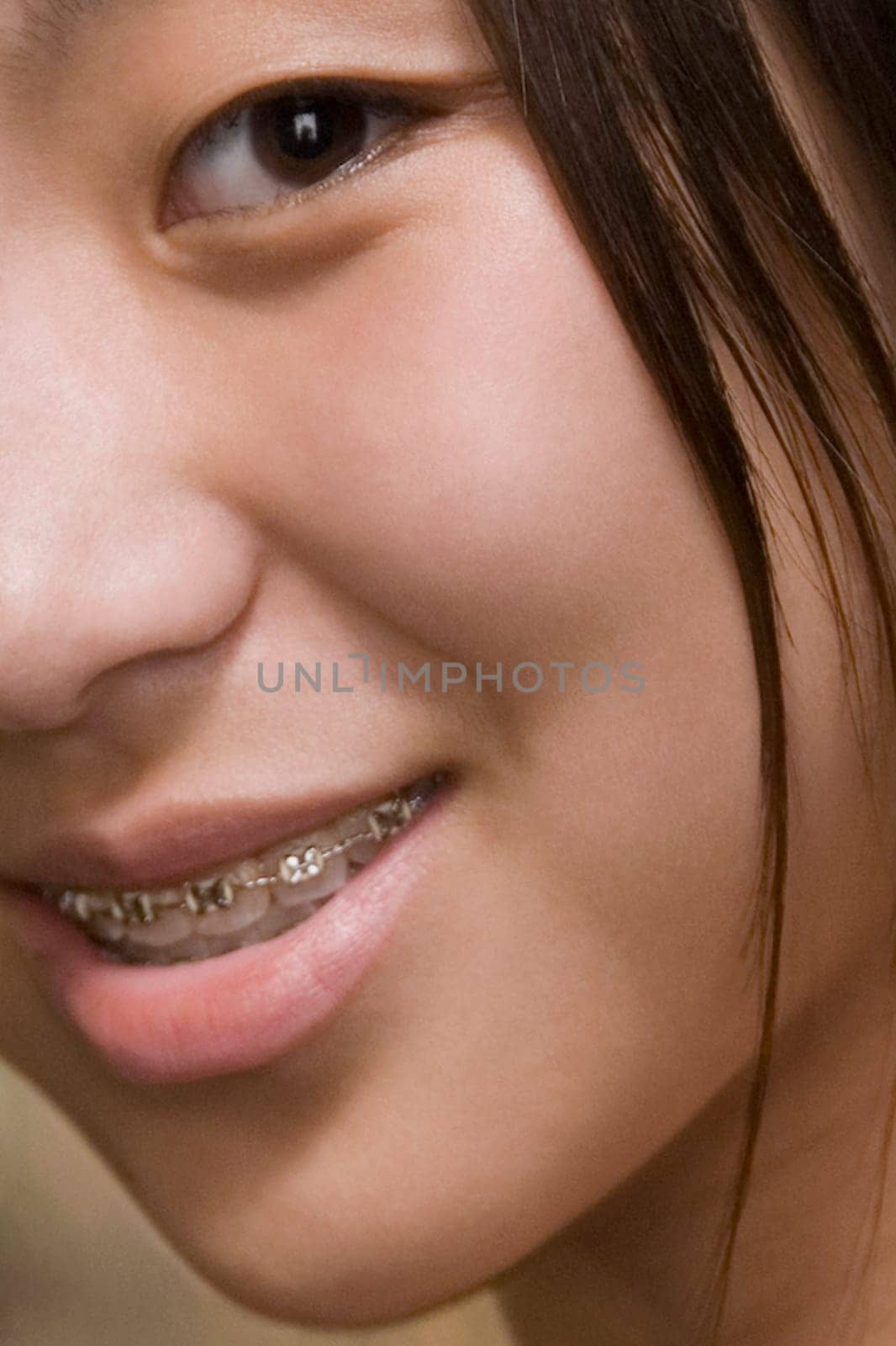 Close-up of a young woman with braces on her teeth