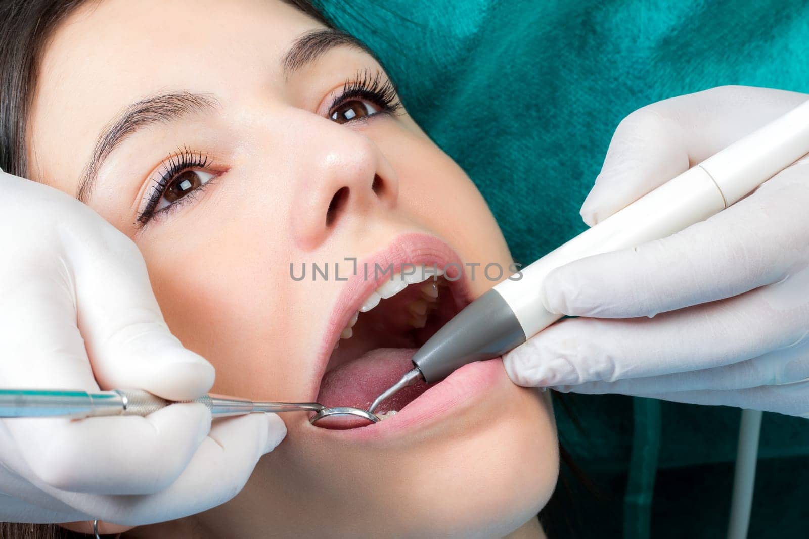 Close up macro face shot of girl at dental check up.Dental hygienist cleaning girls teeth with air scaler and mouth mirror.