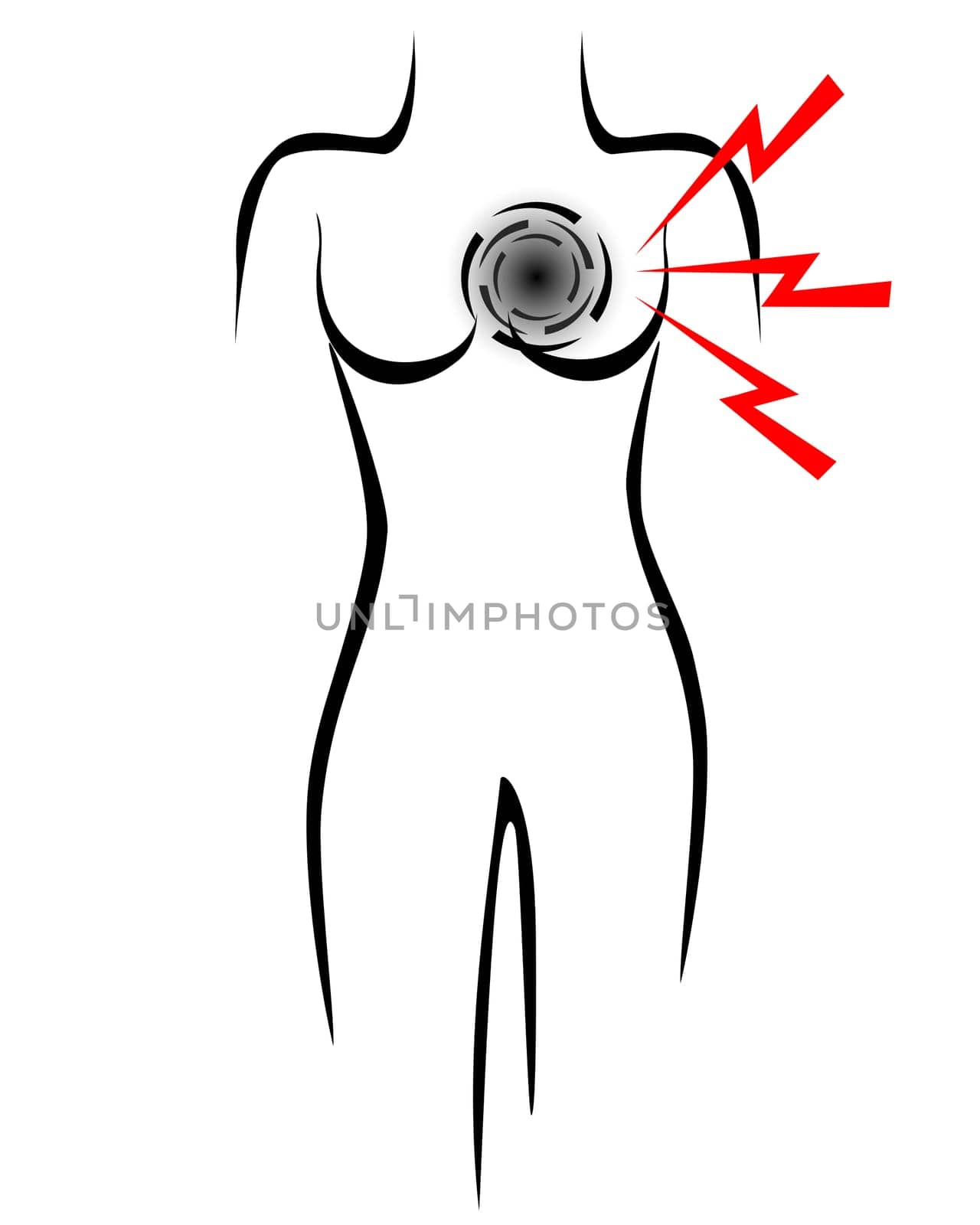 Stilisierter Frauenkörper mit Symbol für Herzinfarkt