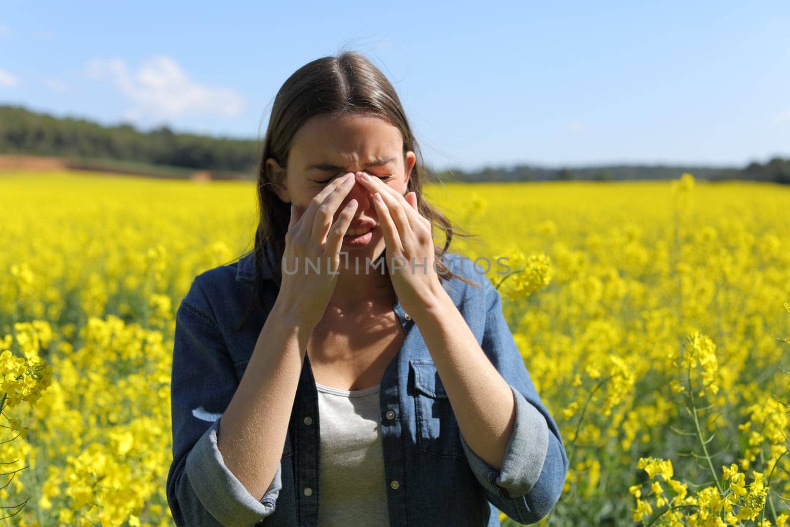 Allergic woman scratching itchy eyes in spring season in a yellow flowered field