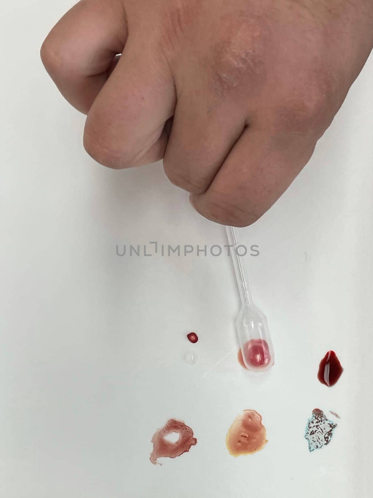 Medical doctor performing a quick blood group determination by using blood type testing kit with anti A and B antibodies on a white card. High quality photo