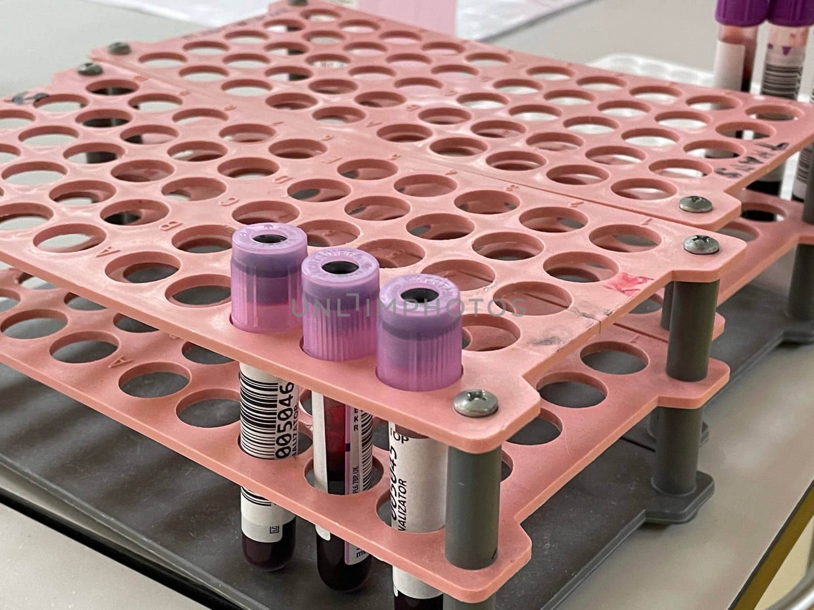 Laboratory interior, test lab, blood samples from patients with viral pneumonia to be tested for presence of nucleic acids for SARS-CoV-2 and flu virus and specific antibodies against the viruses. High quality photo