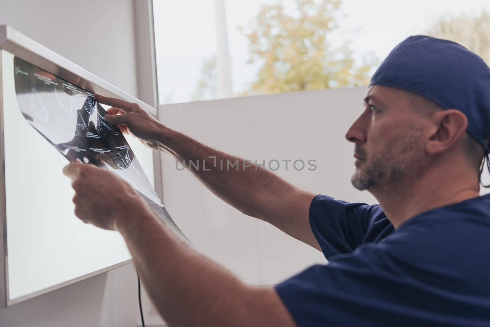 Orthopedist doctor examining X-ray picture at in hospital or clinic. High quality photo. Selective focus
